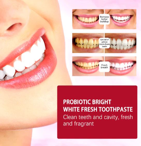 SP4 Toothpaste
